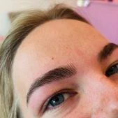 Brow Treatment 1